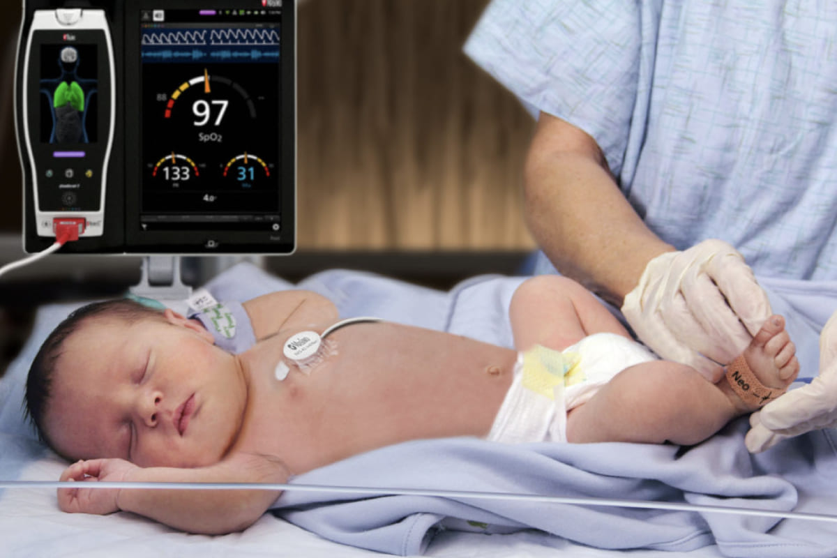 Tamiz Cardíaco Neonatal 
